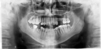 Dental Radiology in Romania