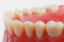 Dental Fillings in Romania