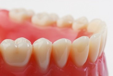 Hyperdontia Treatments in Romania