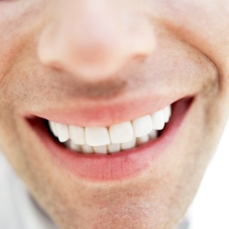 Dental Veneers in Romania