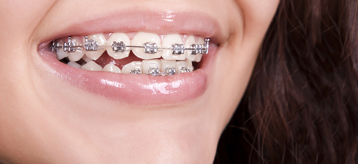 Orthodontics in Romania
