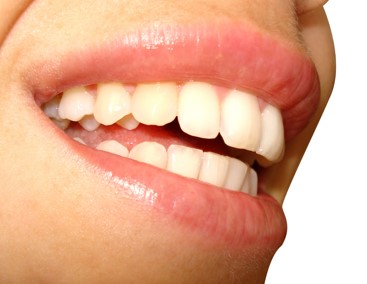 The Snap-on-Smile Technique
