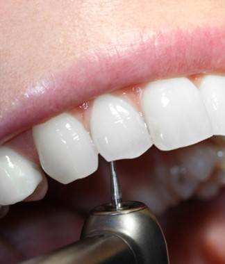 Treatment for Dental Abscess in Romania