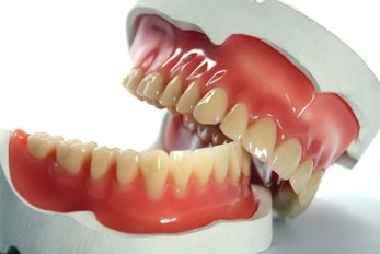 Dental Prosthetics in Romania